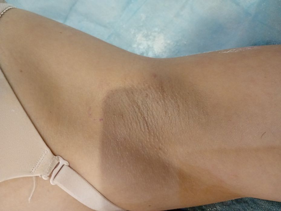 Шугаринг женский воском