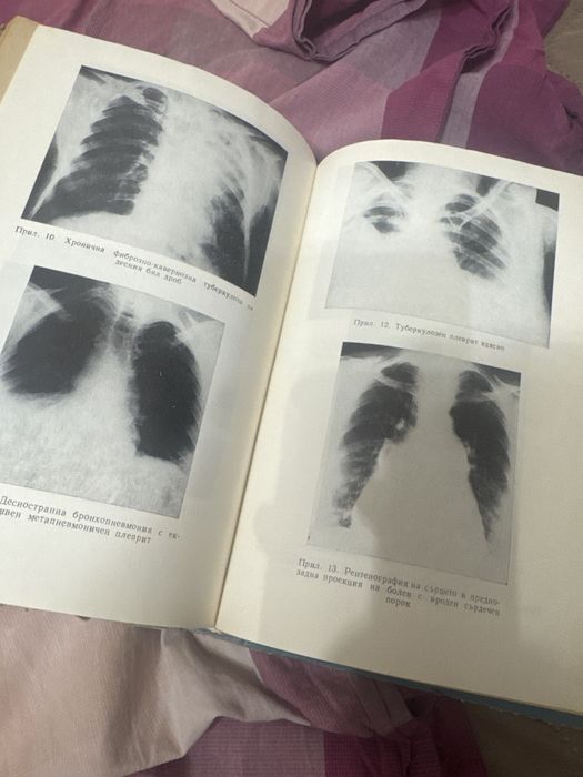 Вътрешни болести проф. АТ. МАЛЕЕВ