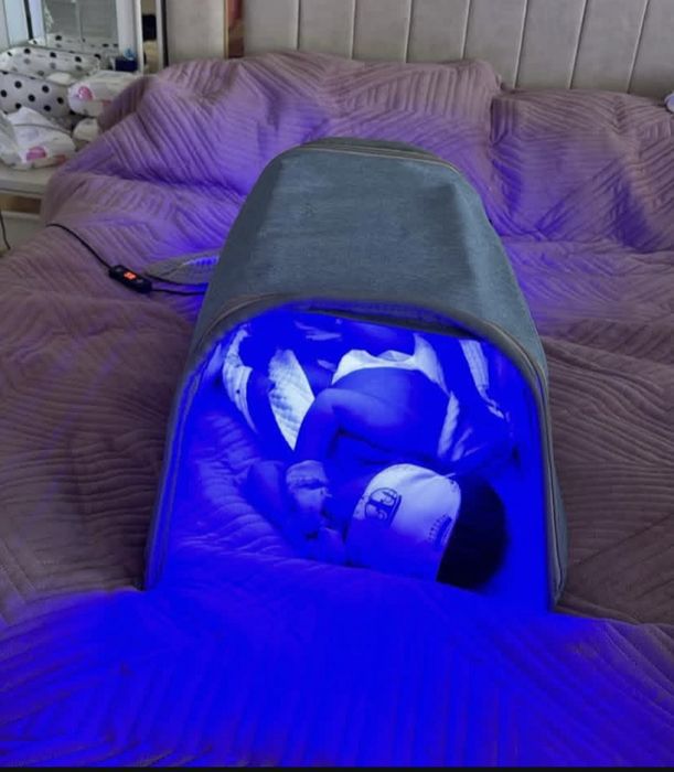 Фотолампа от желтухи