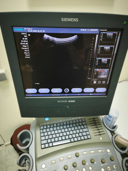 Ехограф Siemens Acuson X300