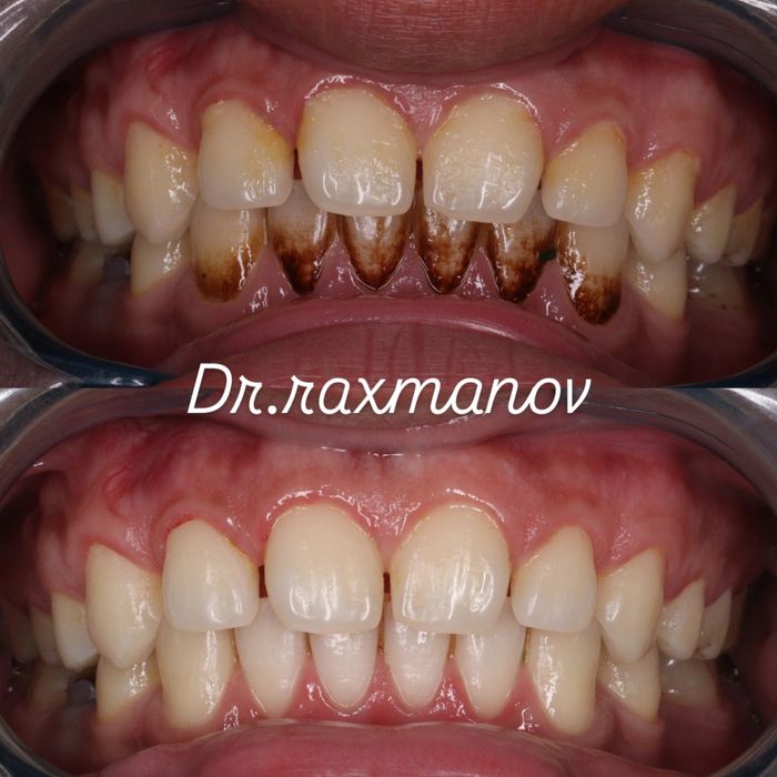 Stomatologiya xizmati Doktor Raxmanov Dadaxon