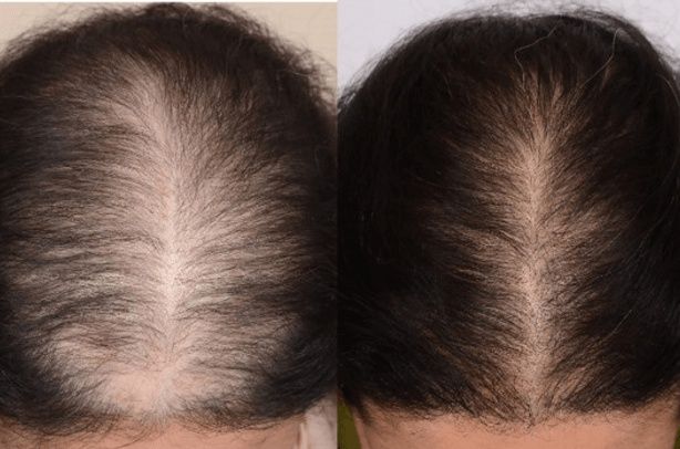 Пищевая добавка для укрепления волос