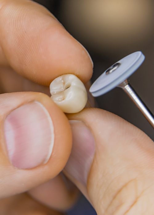 Коронки диоксид циркония