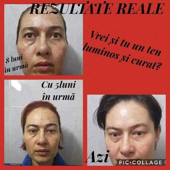 Set  creme cu celule STEM din plante