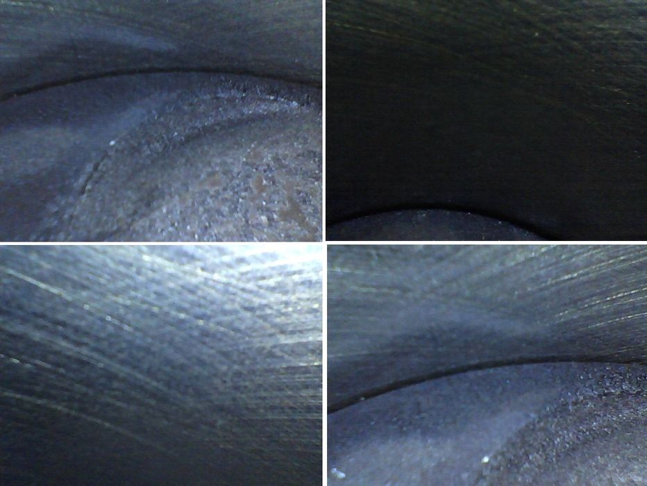 эндаскоп камера билан диагностика хизмати