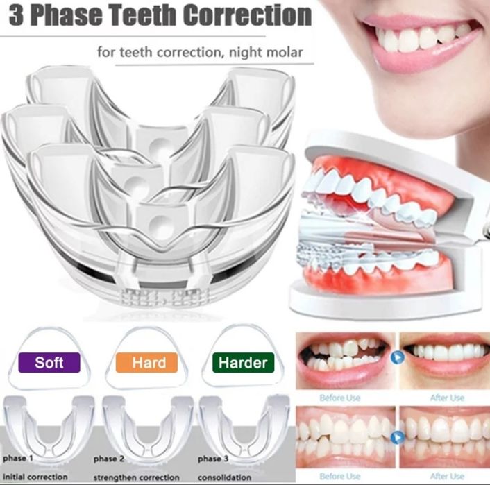 Промо-Ортодонтски коректор,шини,алайнер на зъби брекети зъбен фиксатор