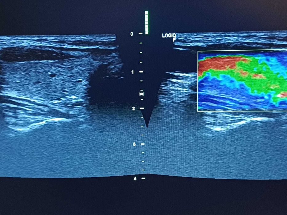 Ecograf stationar GE Logiq F6 cu trei sonde in stare excelenta