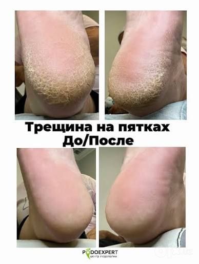 Uyga chiqib manikyur va pedikyur xizmati. Ayollar va erkaklar uchun