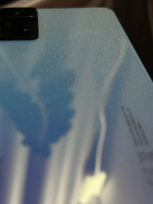 Xiaomi redmi note 11
