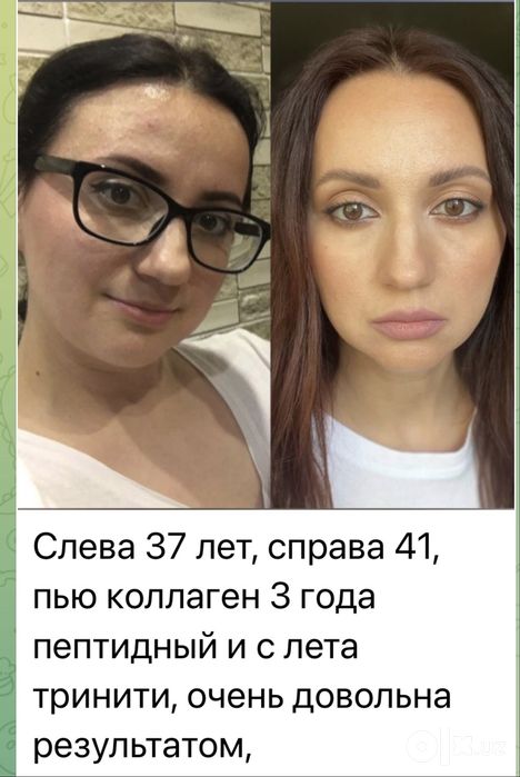 Коллаген тринити- для здоровья и красоты кожи, волос, ногтей, суставов
