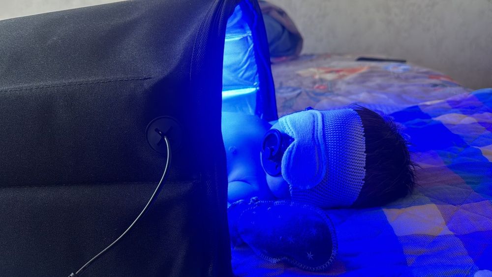 Лампа от желтушки