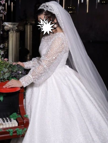 Oq koylak Holati zor