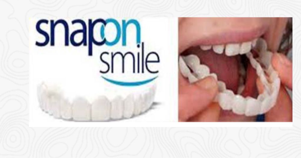 Фасети SnapOn Smile
