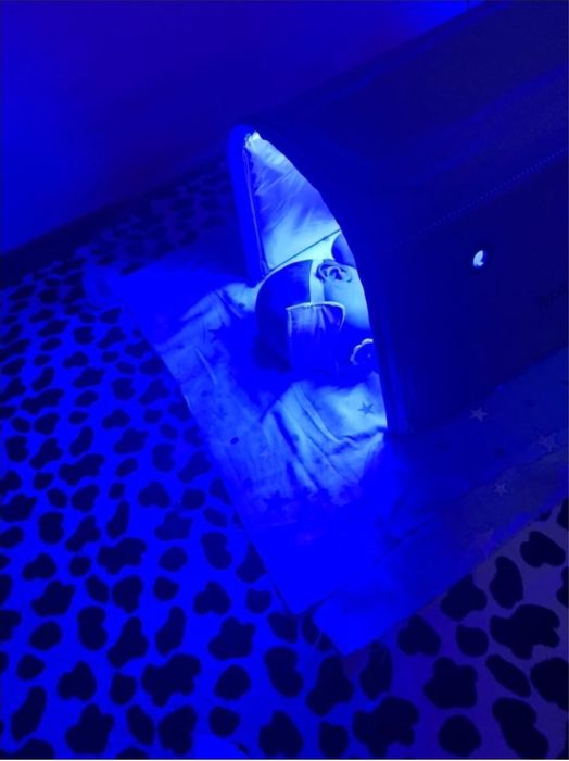 Фотолампа от желтухи