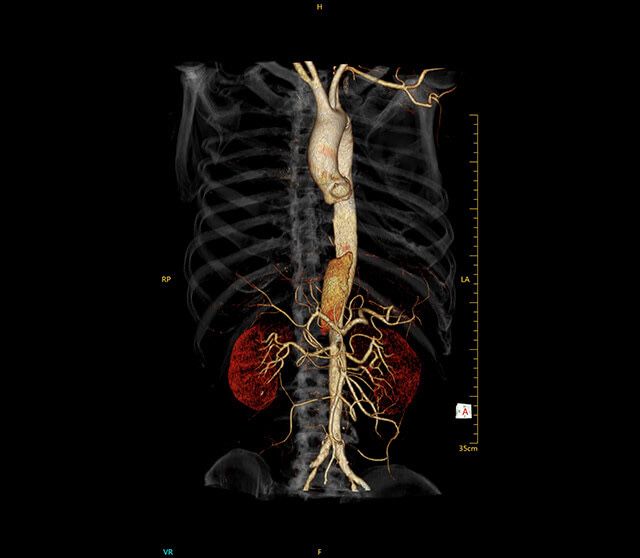 Компьютерный томограф КТ 16,32,64,128 среза.