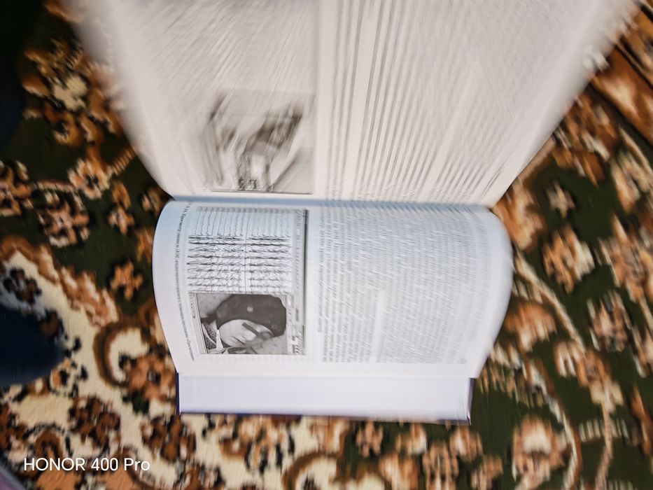 Книги по эпилептологии