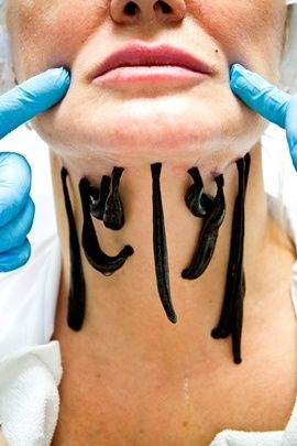 Продаю медицинские пиявки оптом и в розницу Zuluk sotiladi