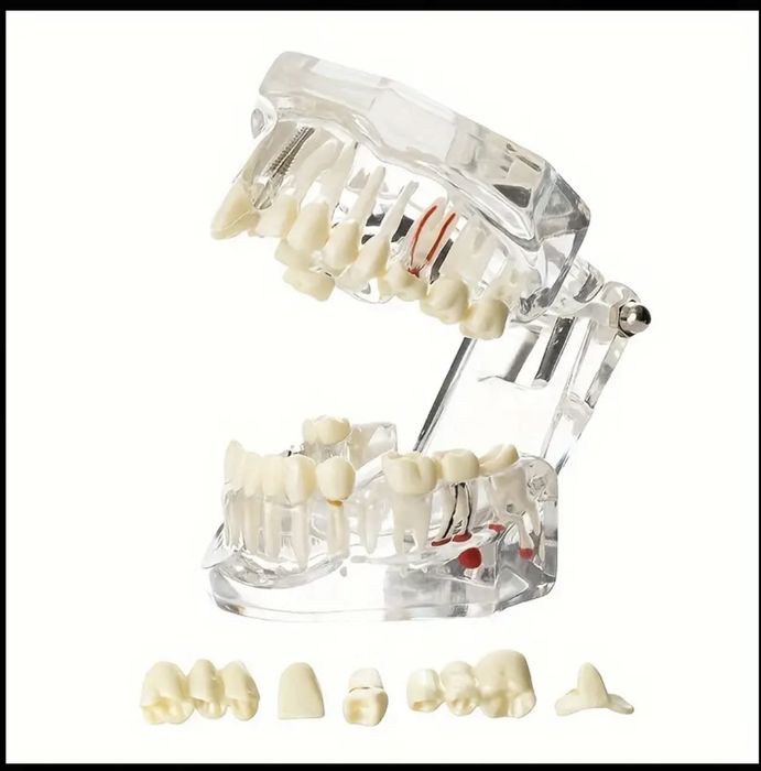 Модели для стоматологов. Модель зубов для обучения. Стоматология