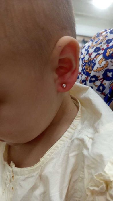Quloq burun teshish uchun 12-yillik tajribali YulduzCha