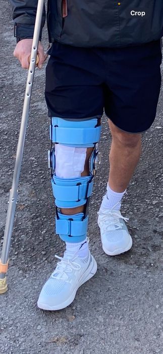 Ортопедична  ортеза