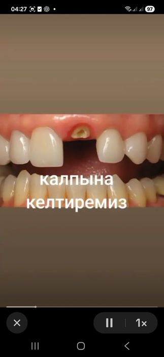 Биликти маман тажирибели Стоматолог