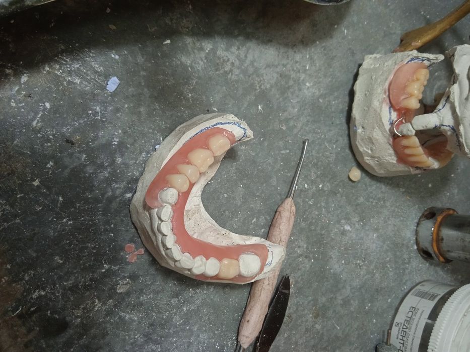 Продам протезы съёмные