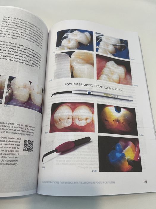 Biomimetic Restorative Dentistry  Volume 1 Pascal Magne Urs Belser