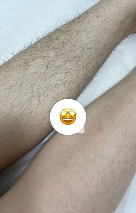 Depilyatsa ga SHOGIRT OLAMAN