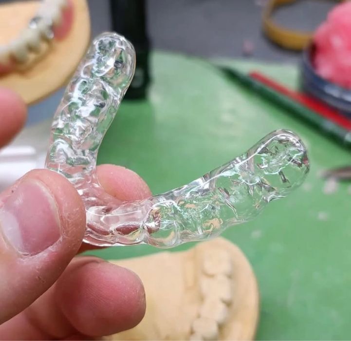 Зубной каппа после брекет