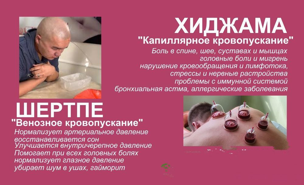 Хиджама и Шертпе