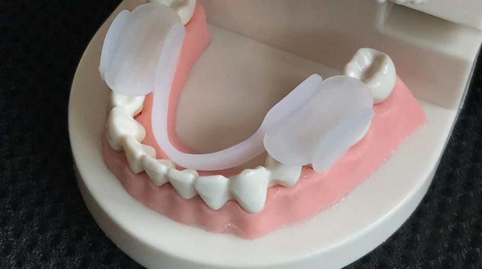 Стоматологический ночной протектор