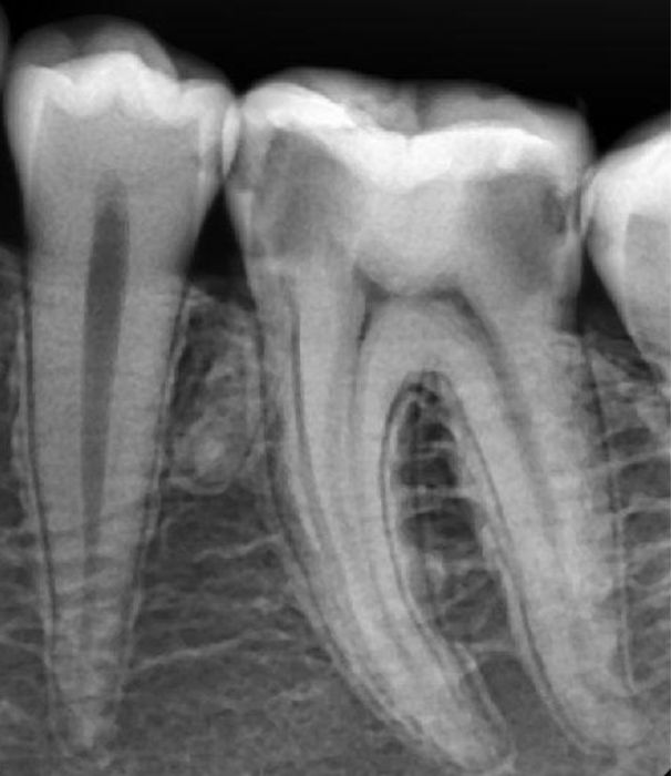 Рентгены и визиографы