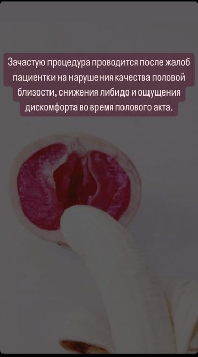 Женское интимное лазерное омоложение