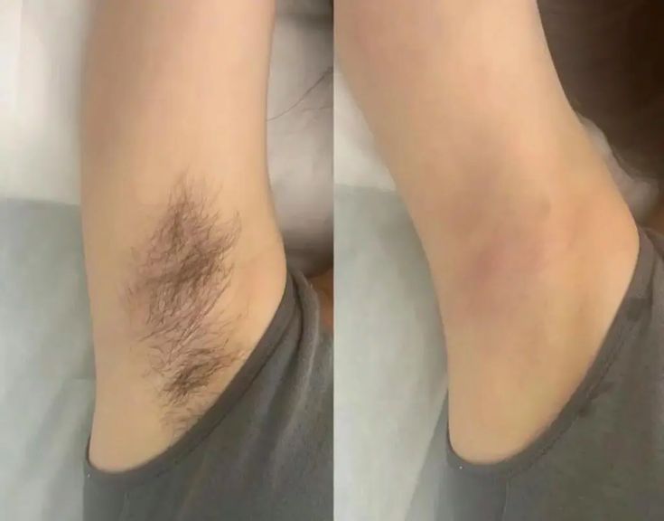 Înfrumusețare profesională