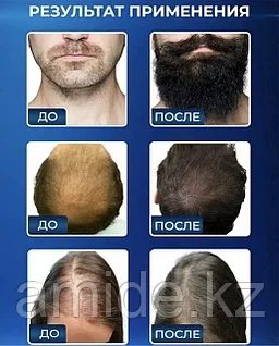 Триоксидил 11% арзан бағада