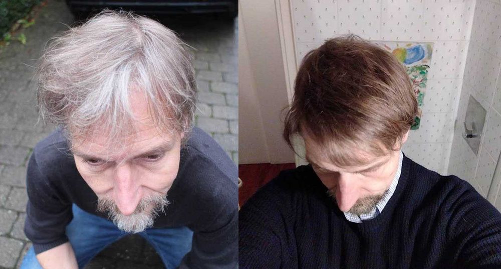 Tratament nat. pt. repigmentarea parului carunt, GR-7 Professional GR7