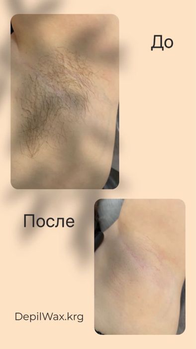 Депиляция воском Майкудук шугаринг