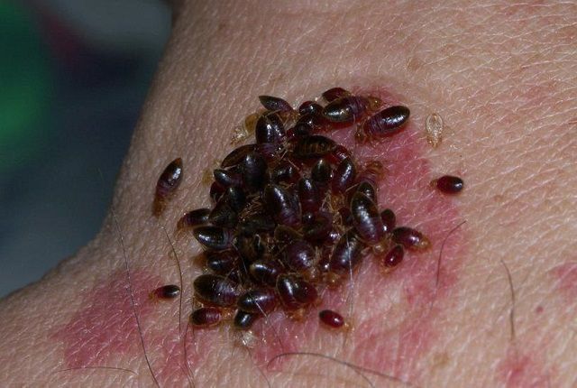 Dezinfeksiya дезинфекция 24/7 dizinfeksiya клапа таракан klapa tarakan