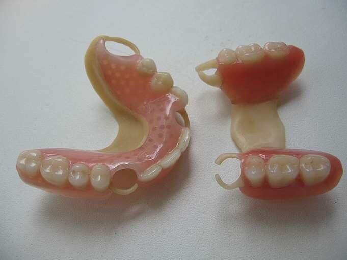 Сьемные Протезирование