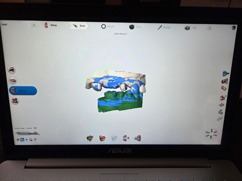 Интраорален скенер Planmeca PlanScan, 2450 EUR