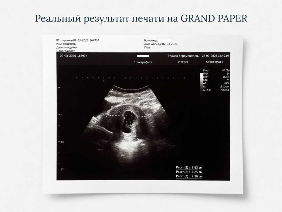 Фотобумага для узи принтеров