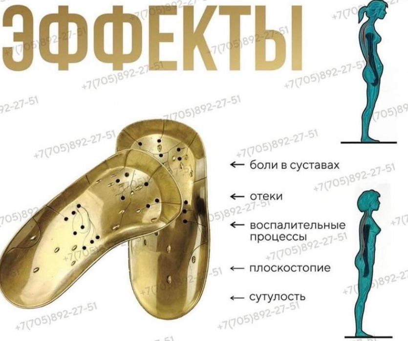 Коррекционные анионовые стельки