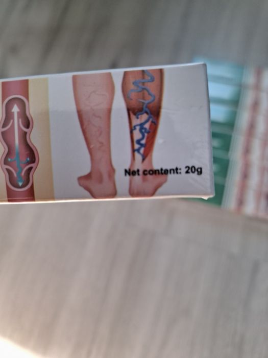 Crema varice tratament picioare