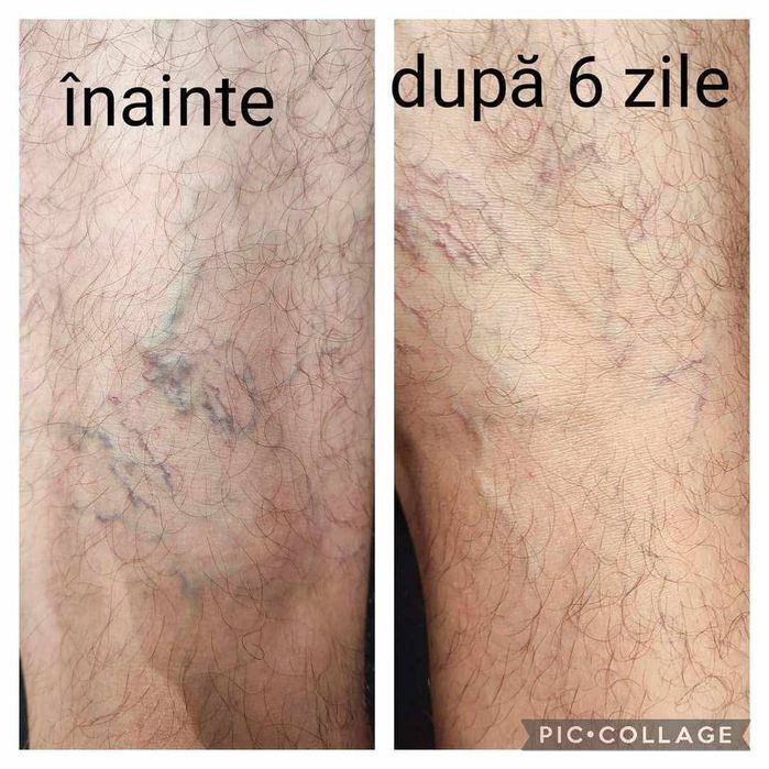Vincì Snep – Supliment Circulație & Picioare Ușoare