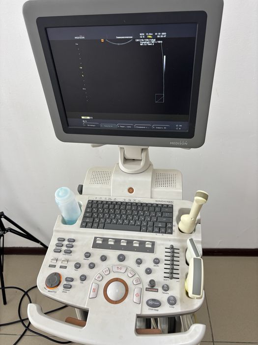Узи аппарат SonoAce R5