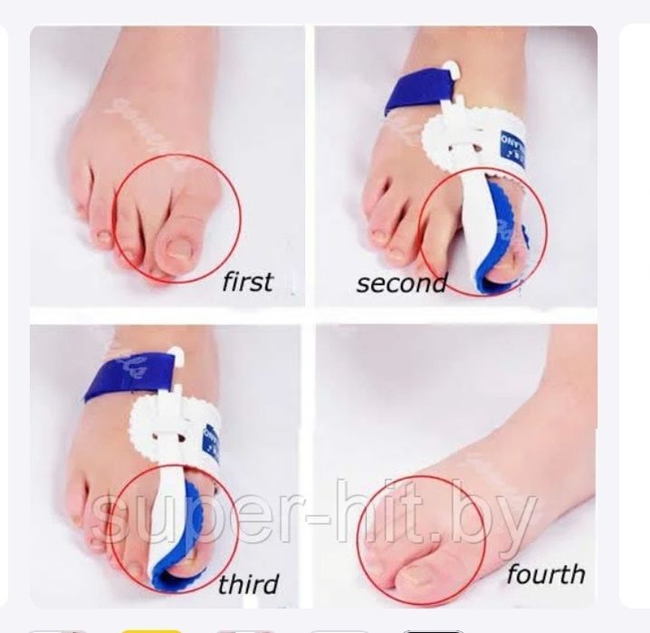 Ночная вальгусная шина