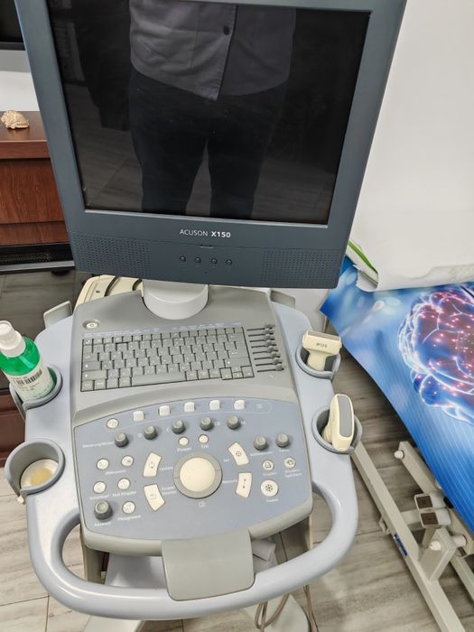 Ecograf siemens acuson x150