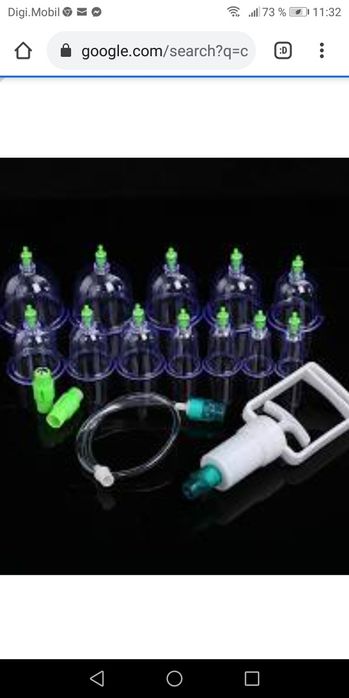 Terapie cu ventuze. Cupping terapie.