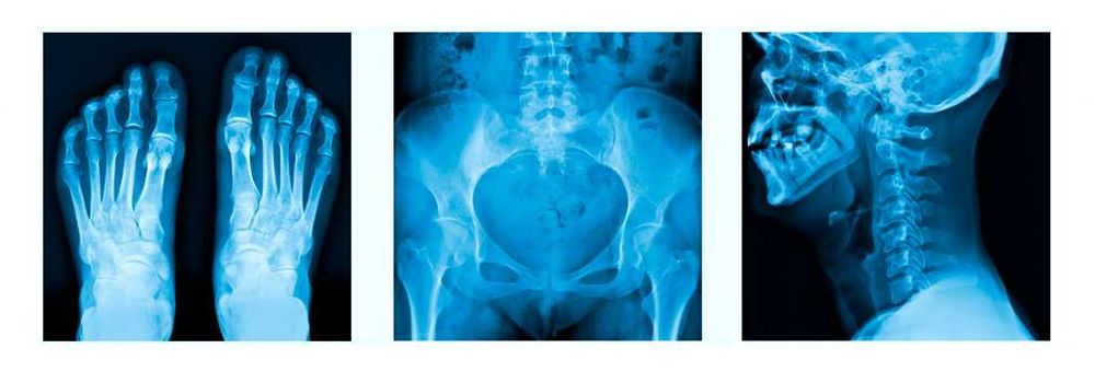 ВТОРО МНЕНИЕ за Компютърна Томография,  Скенер, ЯМР, КТ, Рентген