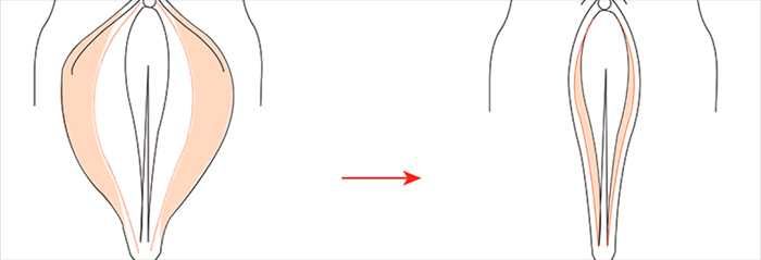 Лабиопластика в Ташкенте. Коррекция интимной зоны безопасно.